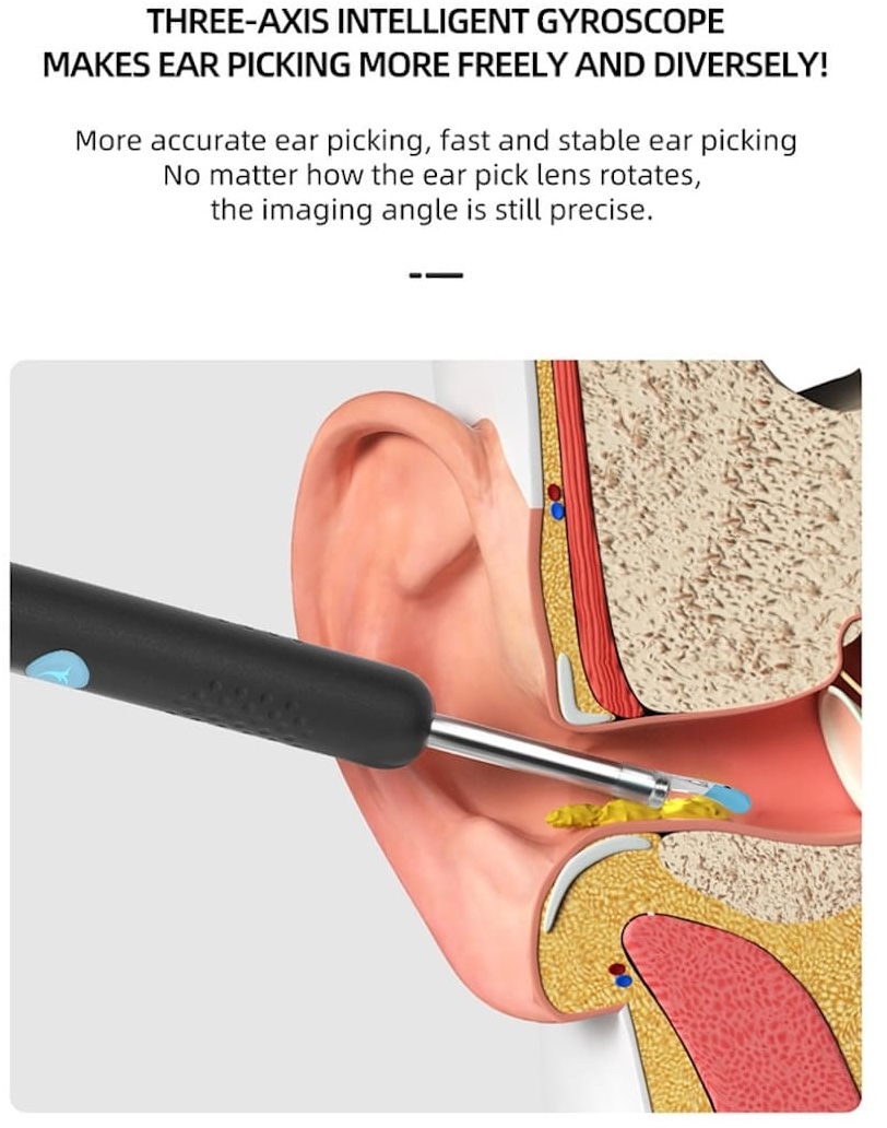 penghilang kotoran telinga dengan kamera pembersih telinga